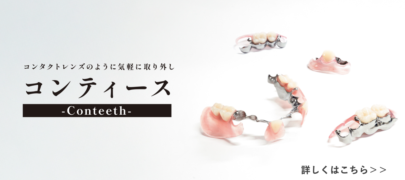 コンティースデンチャーの画像